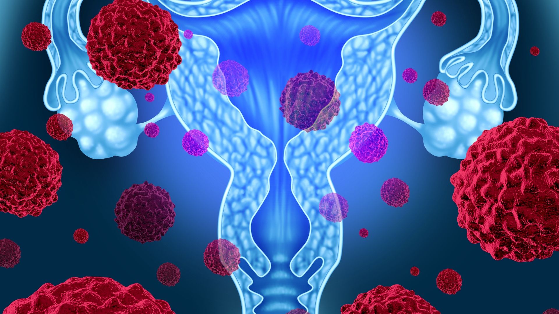 uterine fibroid treatment