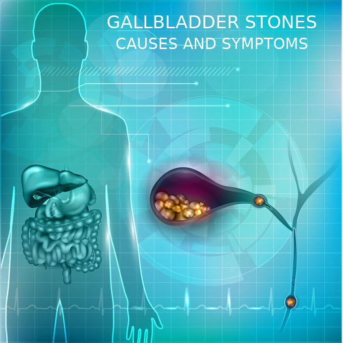 Gallstones Causes and Symptoms