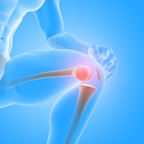 how long does a artificial knee last